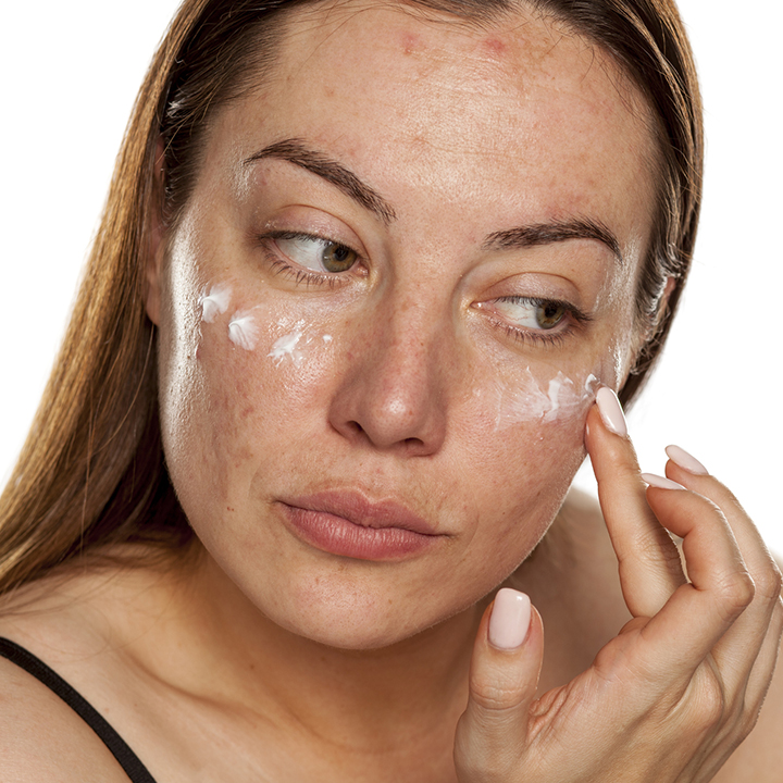 Clareadores de pele: descubra os melhores ativos e produtos | Bioage