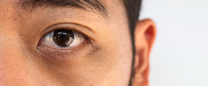 Produtos e ativos para olheiras: quais recomendar? | Bioage