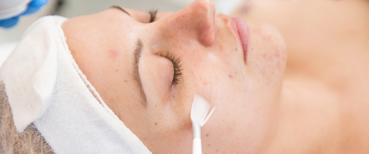 Pós-peeling: como cuidar da pele após o procedimento | Bioage