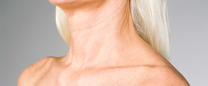 12 tratamentos estéticos para rejuvenescer o pescoço | Bioage