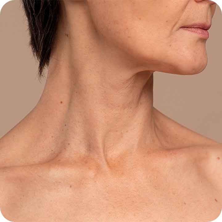 12 tratamentos estéticos para rejuvenescer o pescoço | Bioage